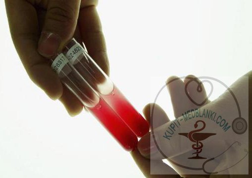 ������ ������ �� ������� � ������